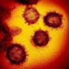 英国から男性帰国後、会食相手の２人が変異種感染　14日間の健康観察期間中に＜新型コ